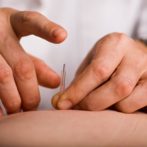 Acupuncture for Stroke